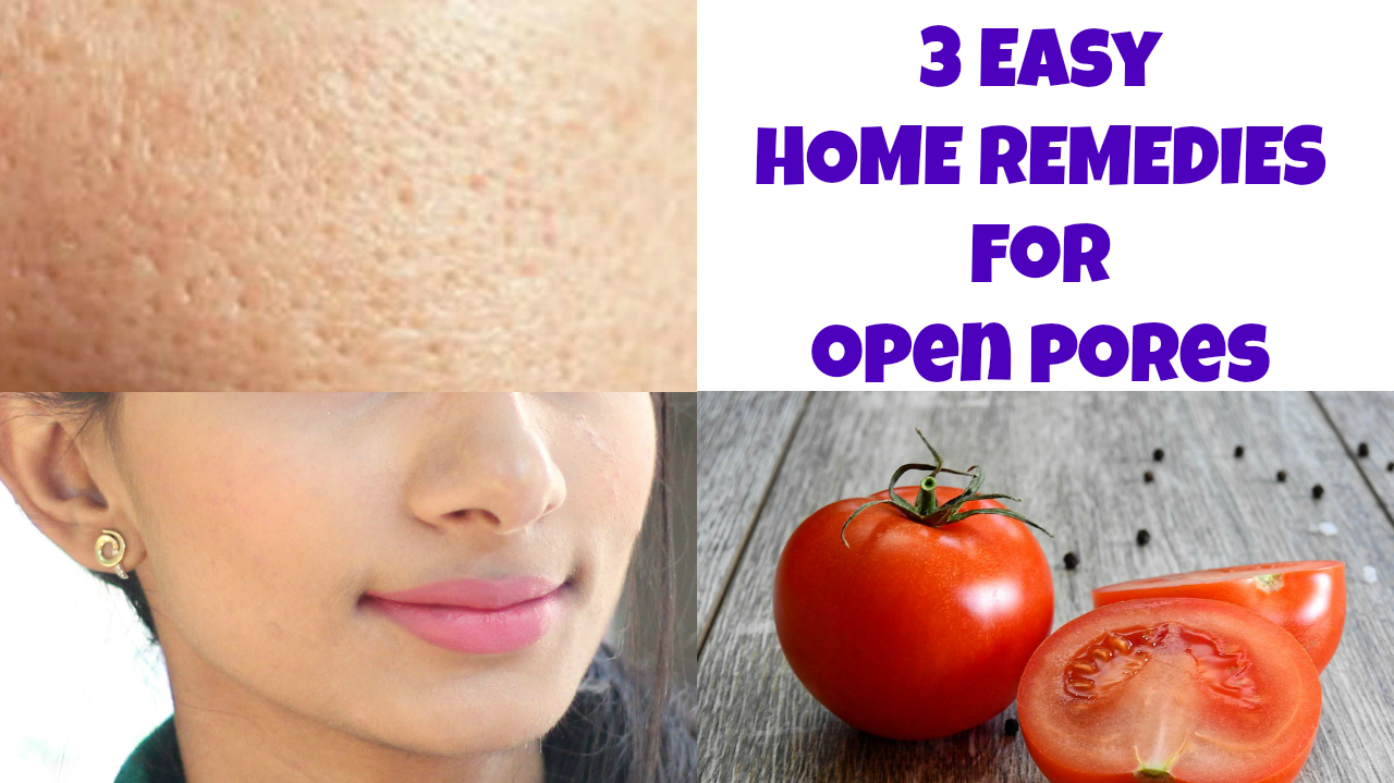 home-remedies-open-pores